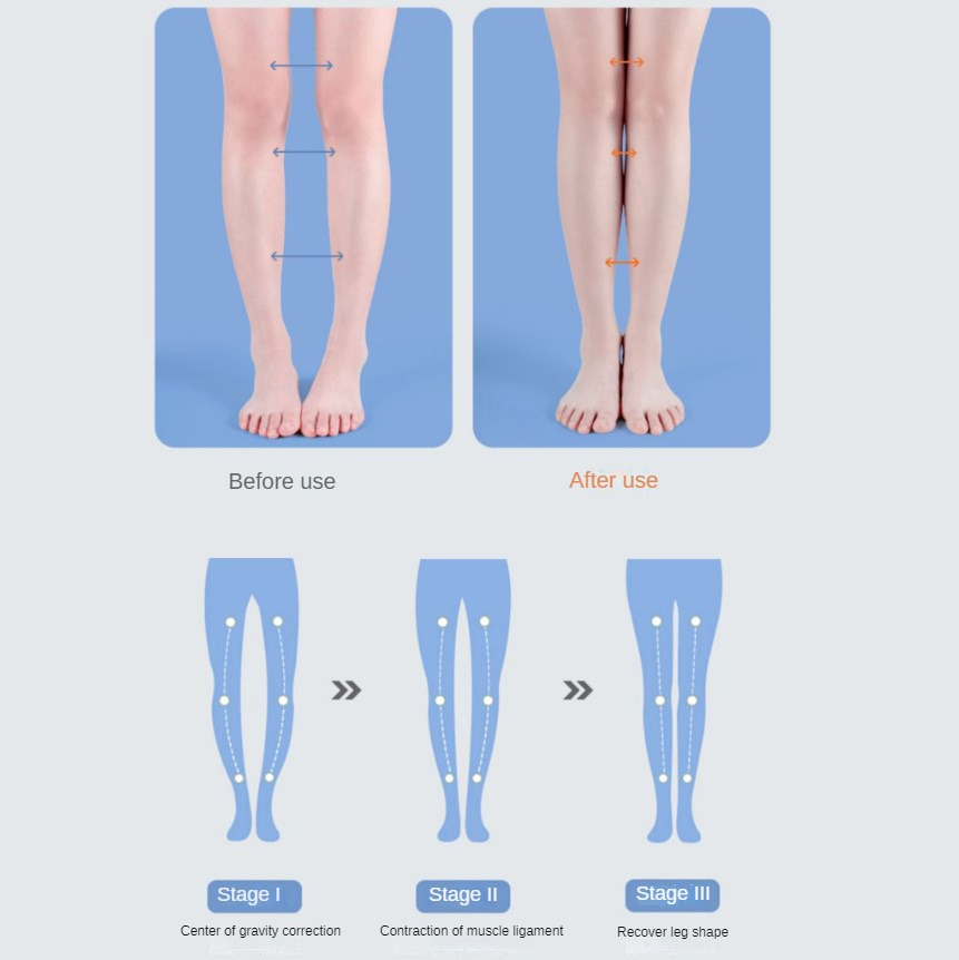 PU พื้นรองเท้า Orthotic Arch ส - Women Shoes Types บทวิจารณ์และราคา